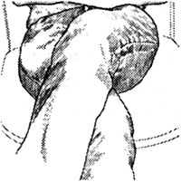 ���������� ����