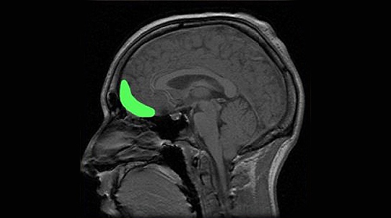 орбитофронтальная кора
