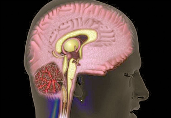 ��� ������������� ������ ������ �� ����