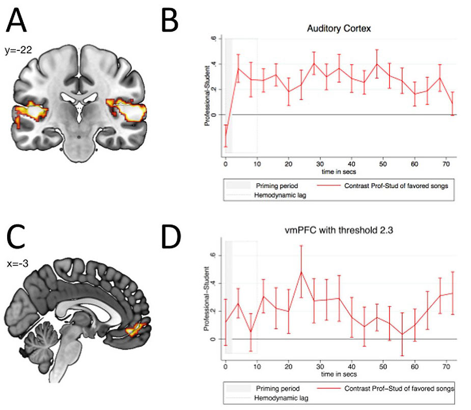 Auditory Cortex - vmPFC