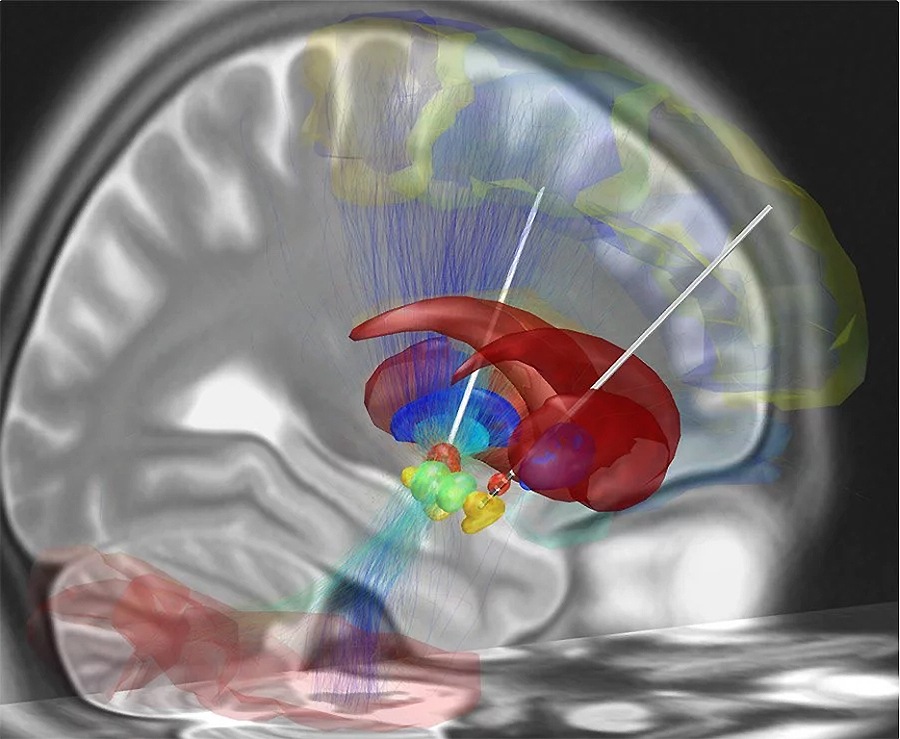 ���� � ��������