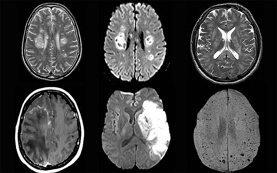 ������� ������������ Covid-19 �� ����